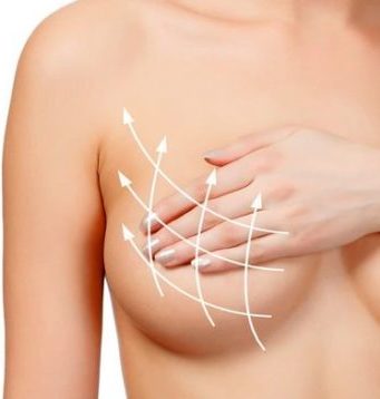 В каких случаях необходима коррекция ареол?