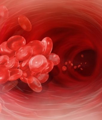 Болезнь свинка: симптомы, лечение и профилактика у детей