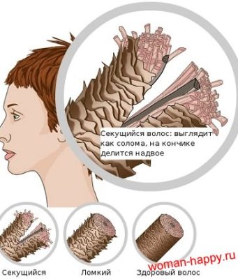 секущиеся кончики волос