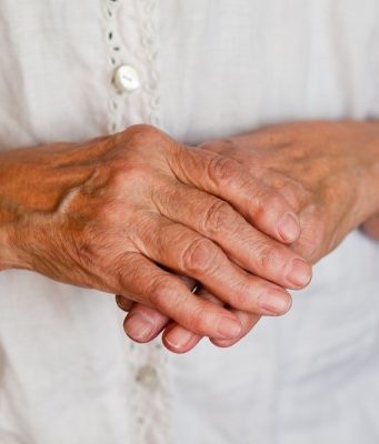 Артрит: симптомы, лечение и диета. Лечение артрита народными средствами