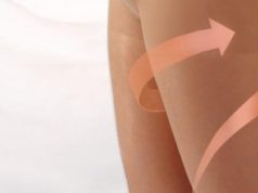 Профилактика варикоза вен на ногах при беременности