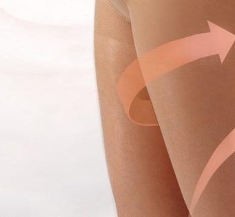 Профилактика варикоза вен на ногах при беременности