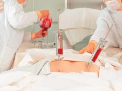 Особенности аллогенной и аутогенной трансплантации при онкологии