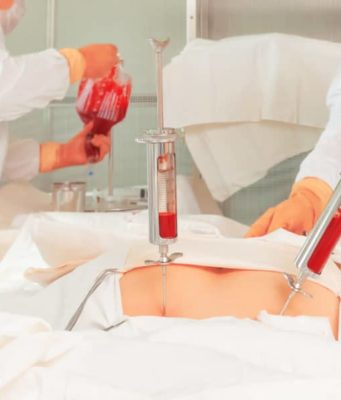 Особенности аллогенной и аутогенной трансплантации при онкологии