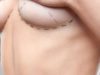 Немного о подтяжке груди