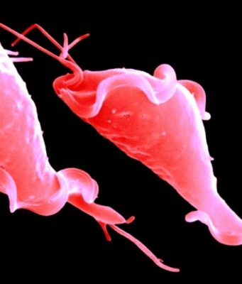 Трихомониаз – симптомы, причины, лечение