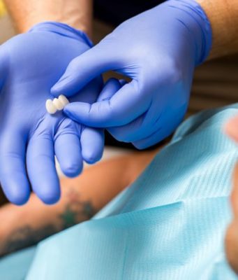 Типы мостовидных протезов