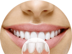 Зубные импланты: оптимальный вариант восстановить утраченные зубы раз и навсегда