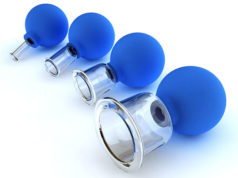 Вакуумные банки для массажа: традиционное китайское лечение