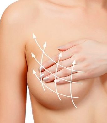 В каких случаях необходима коррекция ареол?