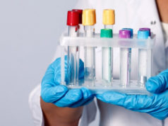 ПЦР-анализ на ИППП: процедура проведения