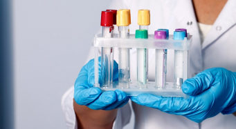 ПЦР-анализ на ИППП: процедура проведения