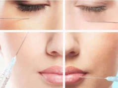 Контурная пластика гиалуроновой кислотой: особенности и эффект процедуры