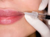 Чем сейчас накачивают губы?