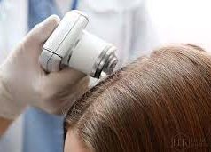 Трихология — лечение выпадения волос