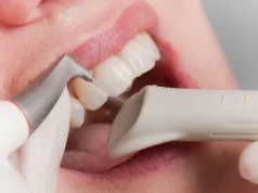 Что за услуга в стоматологии Air Flow?