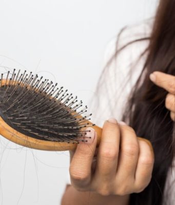 Выпадение волос: какие анализы проводить?