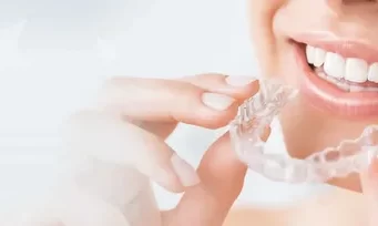 Где лучше исправлять прикус элайнерами: в частной или государственной стоматологии?