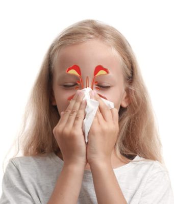 Симптомы, причины и лечение синусита у детей