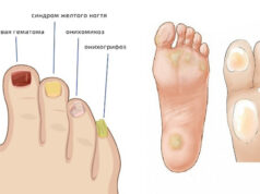 Забота о здоровье ног: когда стоит обращаться к подологу?