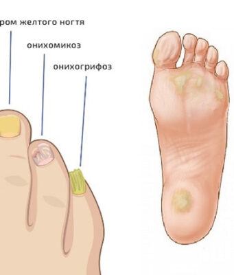 Забота о здоровье ног: когда стоит обращаться к подологу?