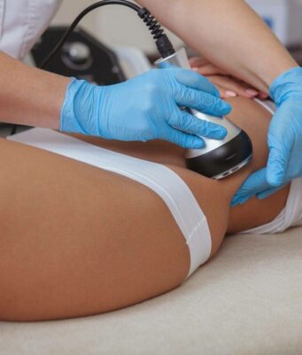 Ультразвуковая липосакция: Преимущества, процесс и результаты